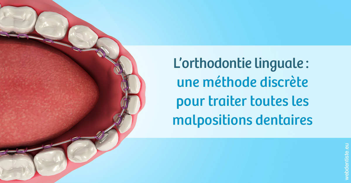 https://dr-potard-marie.chirurgiens-dentistes.fr/L'orthodontie linguale 1