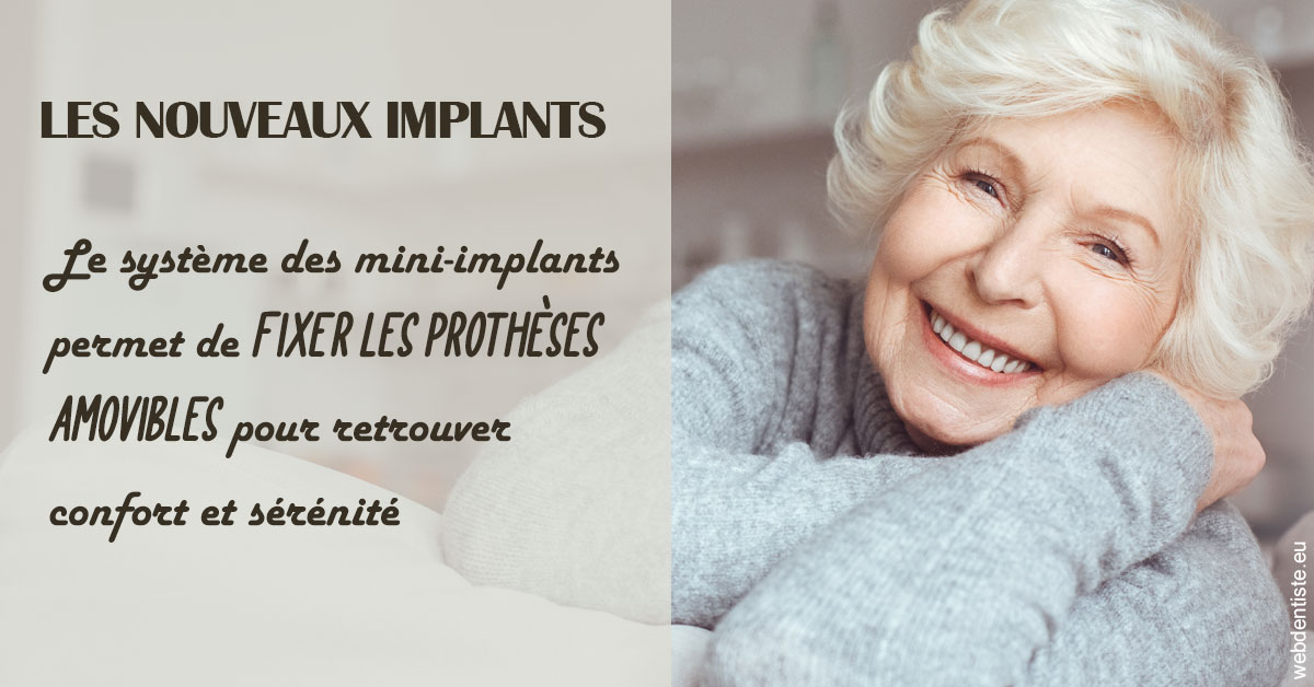 https://dr-potard-marie.chirurgiens-dentistes.fr/Les nouveaux implants 1