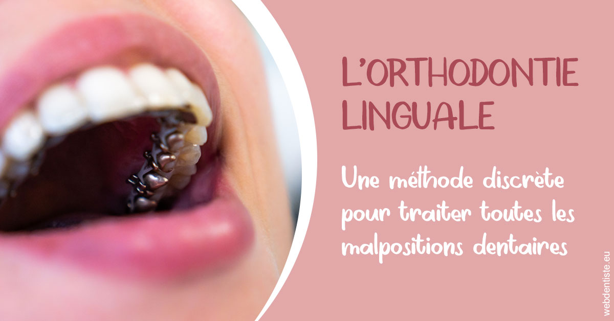 https://dr-potard-marie.chirurgiens-dentistes.fr/L'orthodontie linguale 2