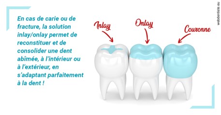 https://dr-potard-marie.chirurgiens-dentistes.fr/L'INLAY ou l'ONLAY