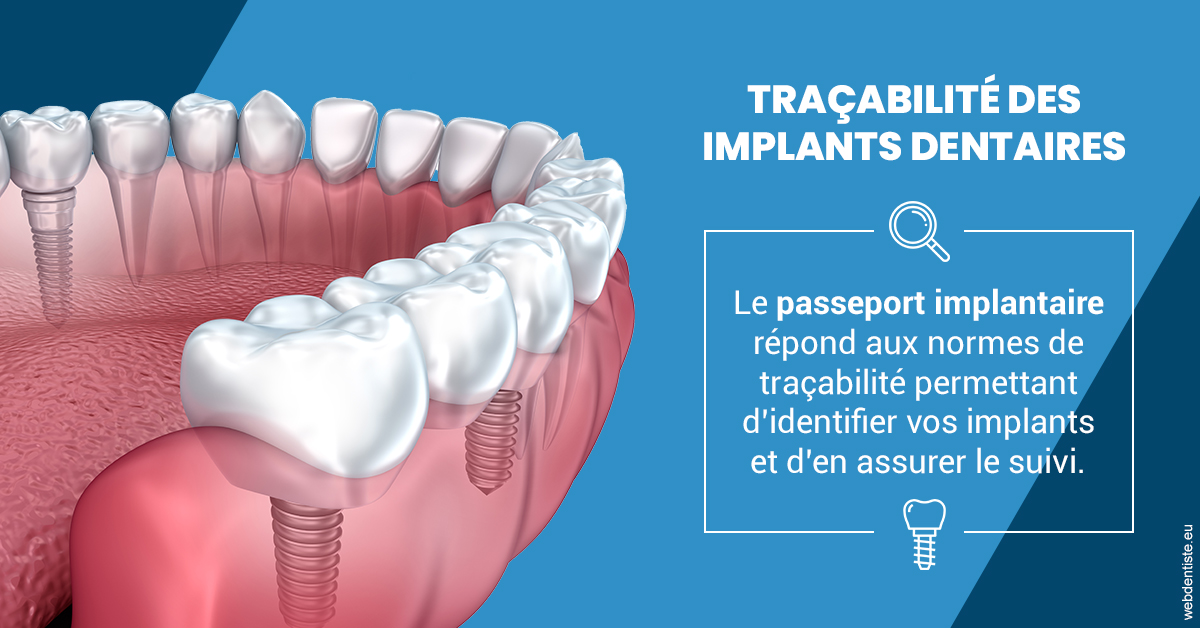 https://dr-potard-marie.chirurgiens-dentistes.fr/T2 2023 - Traçabilité des implants 1