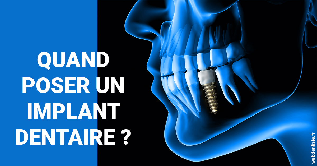 https://dr-potard-marie.chirurgiens-dentistes.fr/Les implants 1