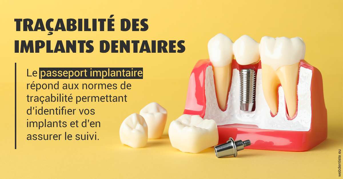 https://dr-potard-marie.chirurgiens-dentistes.fr/T2 2023 - Traçabilité des implants 2