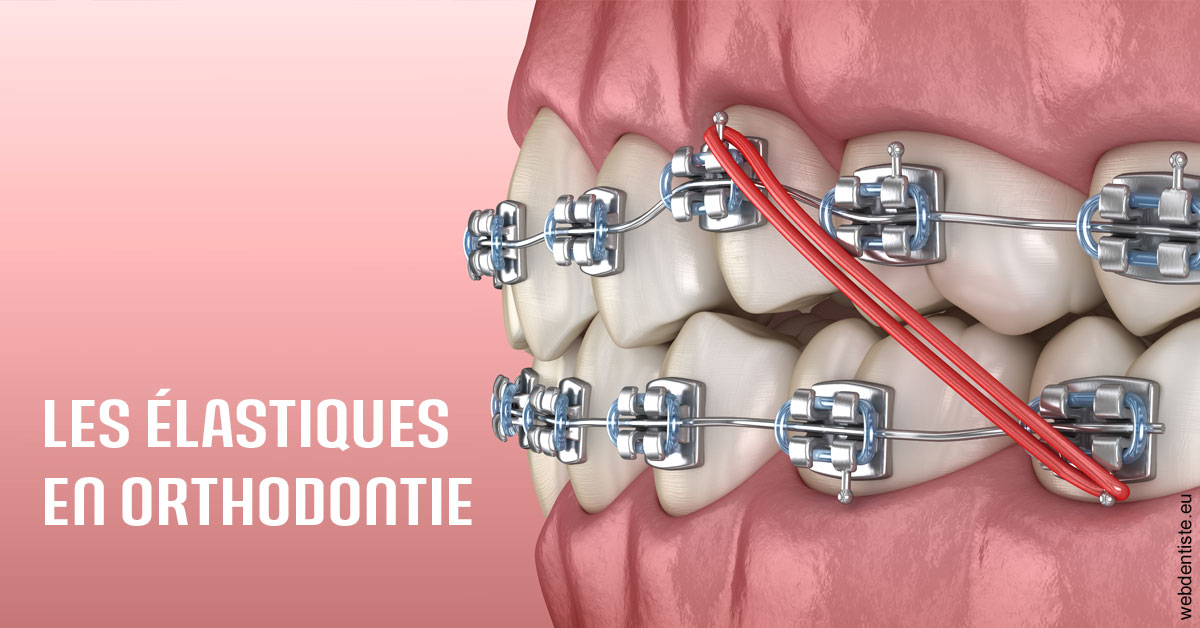 https://dr-potard-marie.chirurgiens-dentistes.fr/Elastiques orthodontie 2