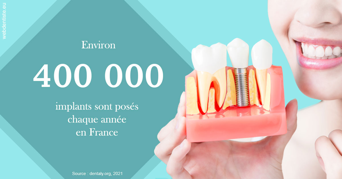 https://dr-potard-marie.chirurgiens-dentistes.fr/Pose d'implants en France 2